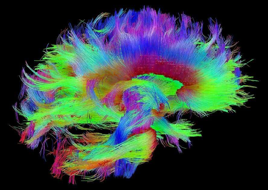 Все, что вы хотели знать об МРТ перфузии головного мозга