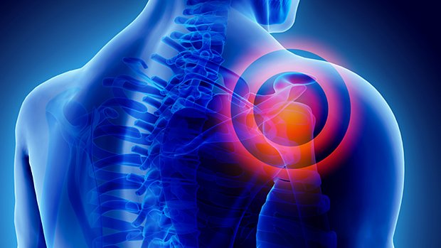 УЗИ плечевого сустава: показания и преимущества диагностики