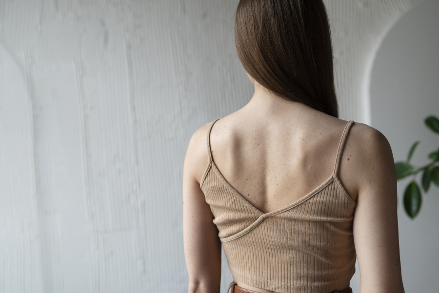 Лучевая терапия при меланоме - фото 9