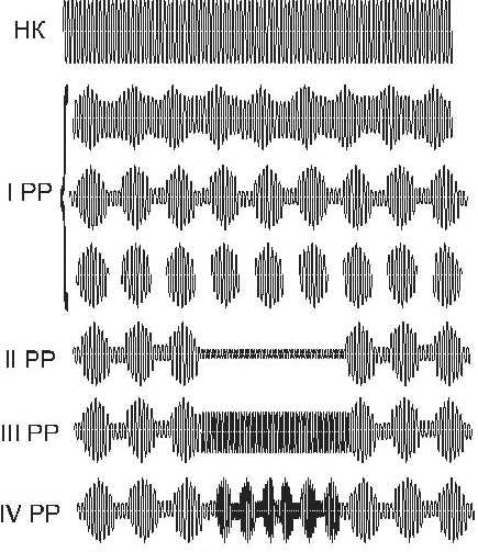 СМТ-терапия - фото 5