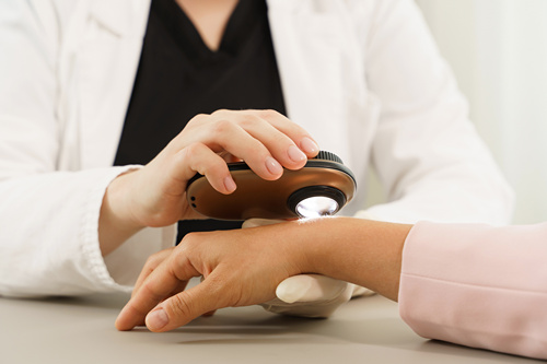 Лучевая терапия базалиомы-2