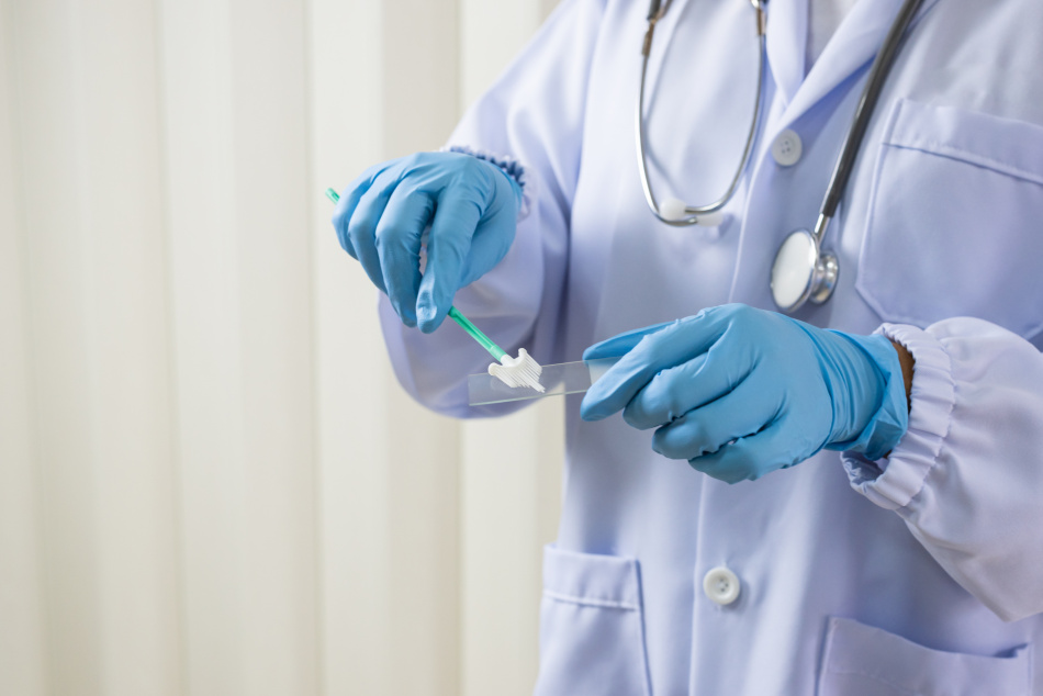 Мазок на цитологию-фото2