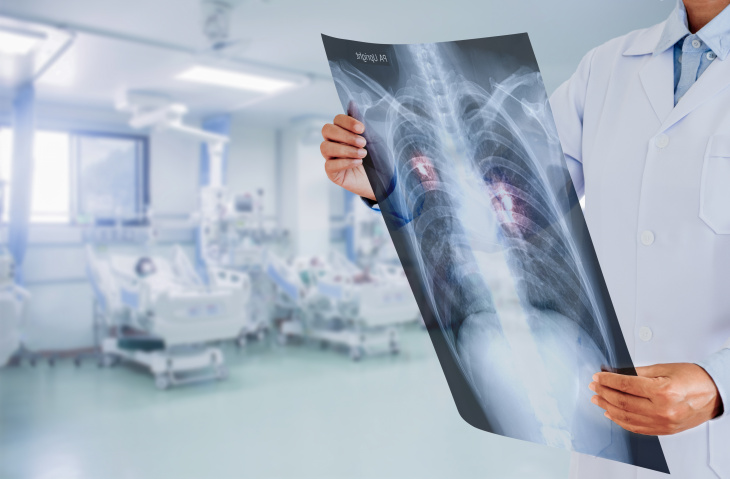 Стадирование рака легкого