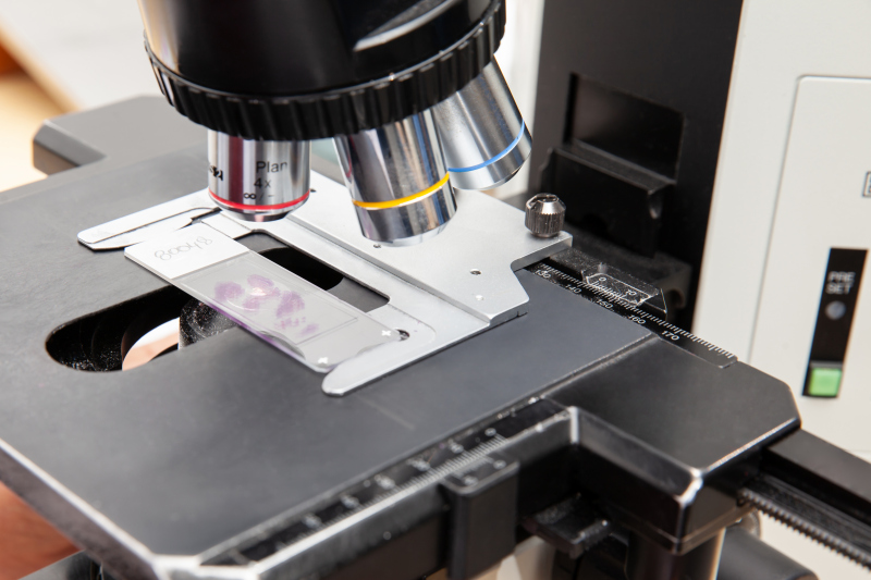 Радиоволновая биопсия шейки матки