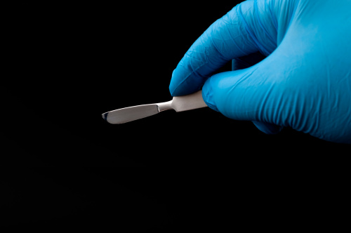 Рассечение синехий малых половых губ-фото4