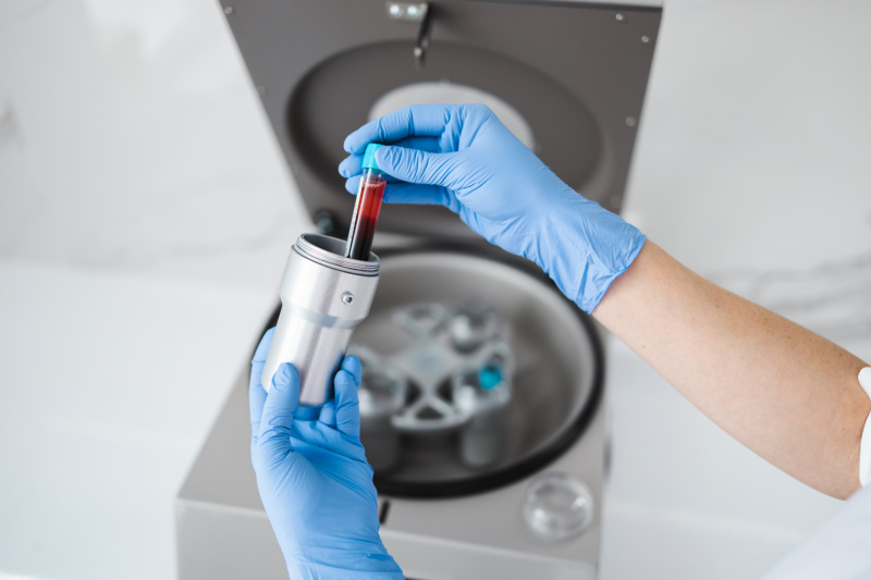 Интимный плазмолифтинг вульвы и промежности