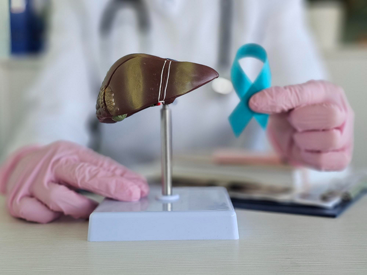 Химиотерапия при раке печени - фото 2