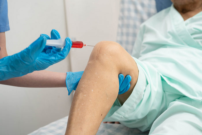 Пункция коленного сустава — диагностика и лечение в одном вмешательстве - фото 2