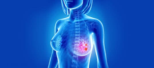 УЗИ молочной железы