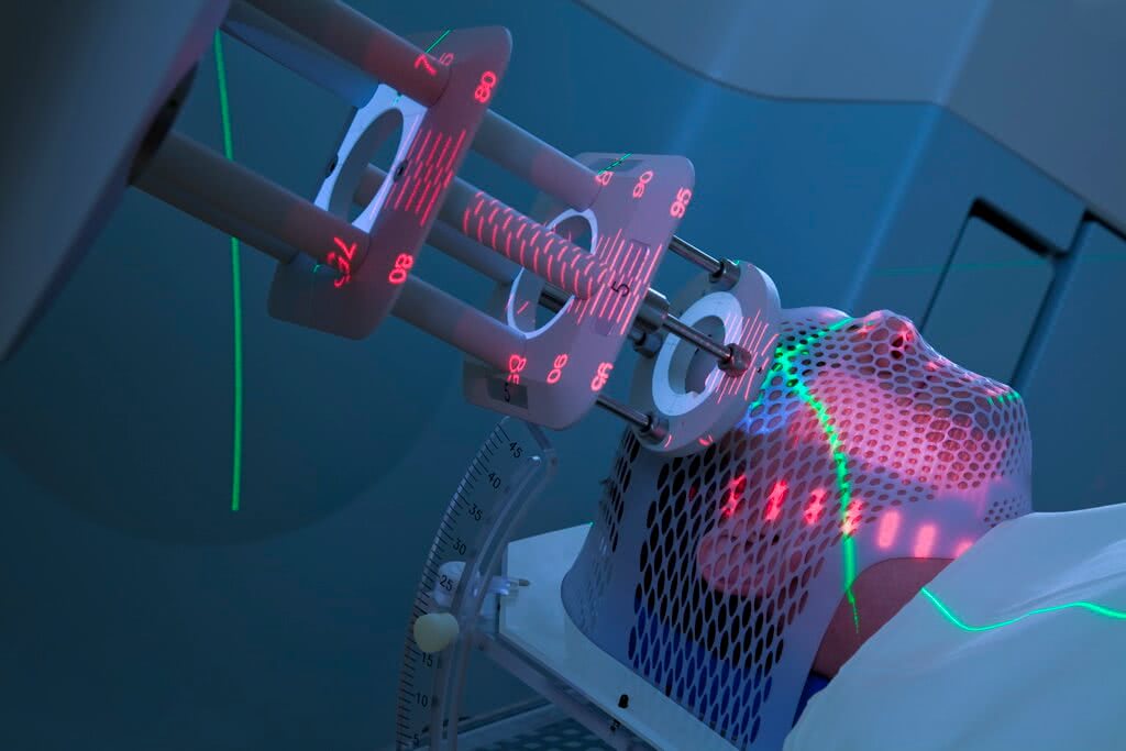 Принцип действия лучевой терапии: избирательное поражение опухолевых клеток