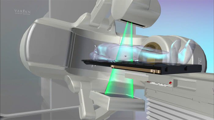 От чего зависит успех курса лучевой терапии