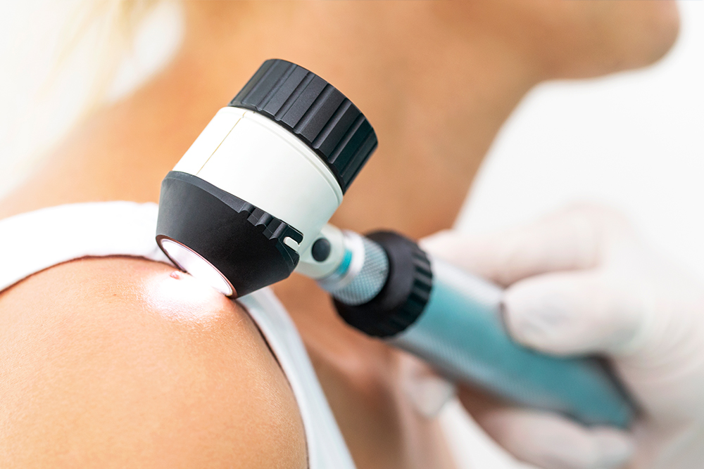 Проведение дерматоскопии в «Медскан»