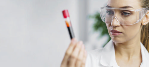 Иммуногистохимия (ИГХ)