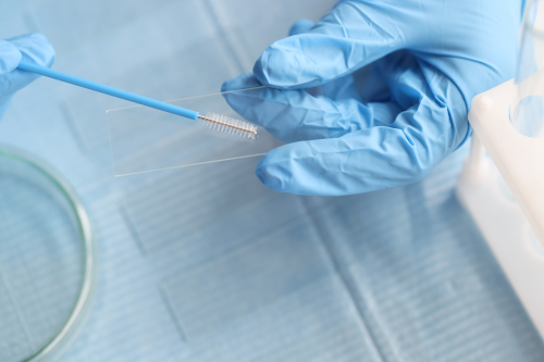 Цитологическое исследование — 5