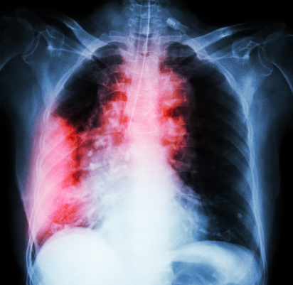 Показания для консультации онколога