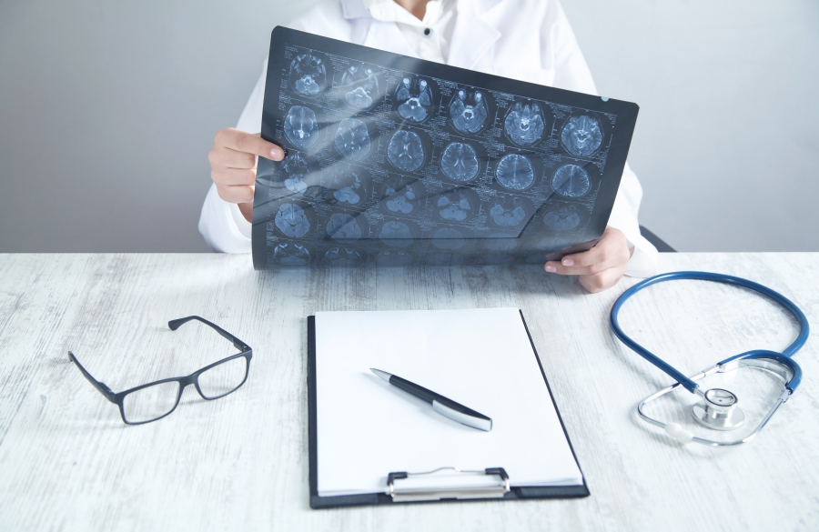 Рак мозга: лучевая терапия