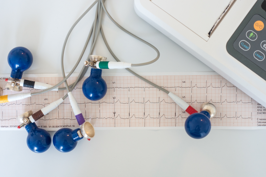 Что такое ЭКГ