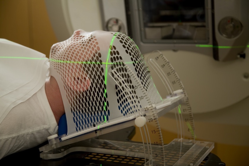 Этапы радиохирургии